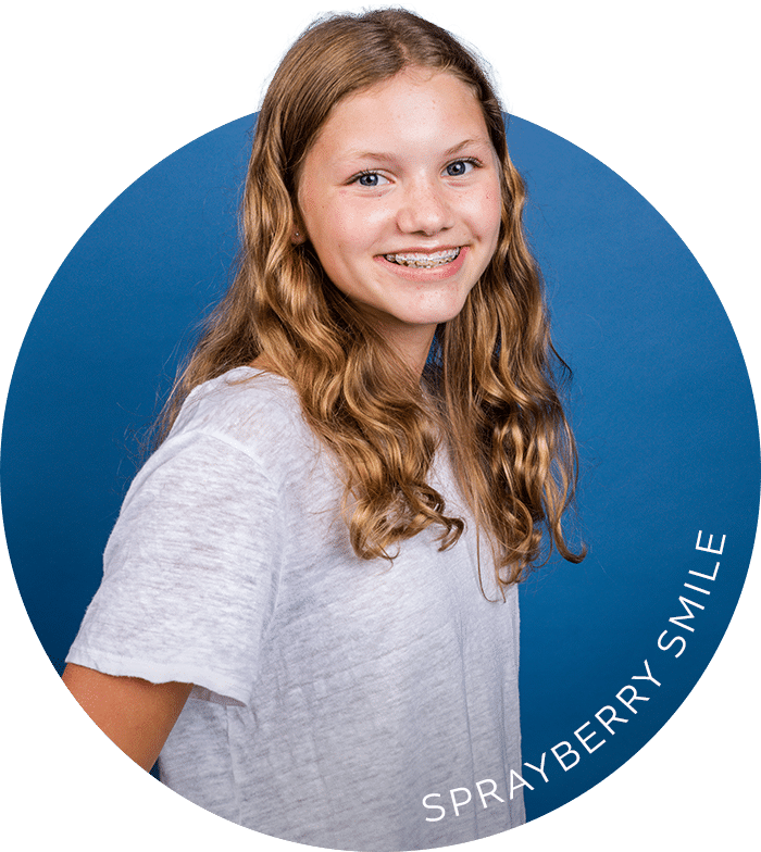 Types of Braces Sprayberry Orthodontics in Auburn, AL