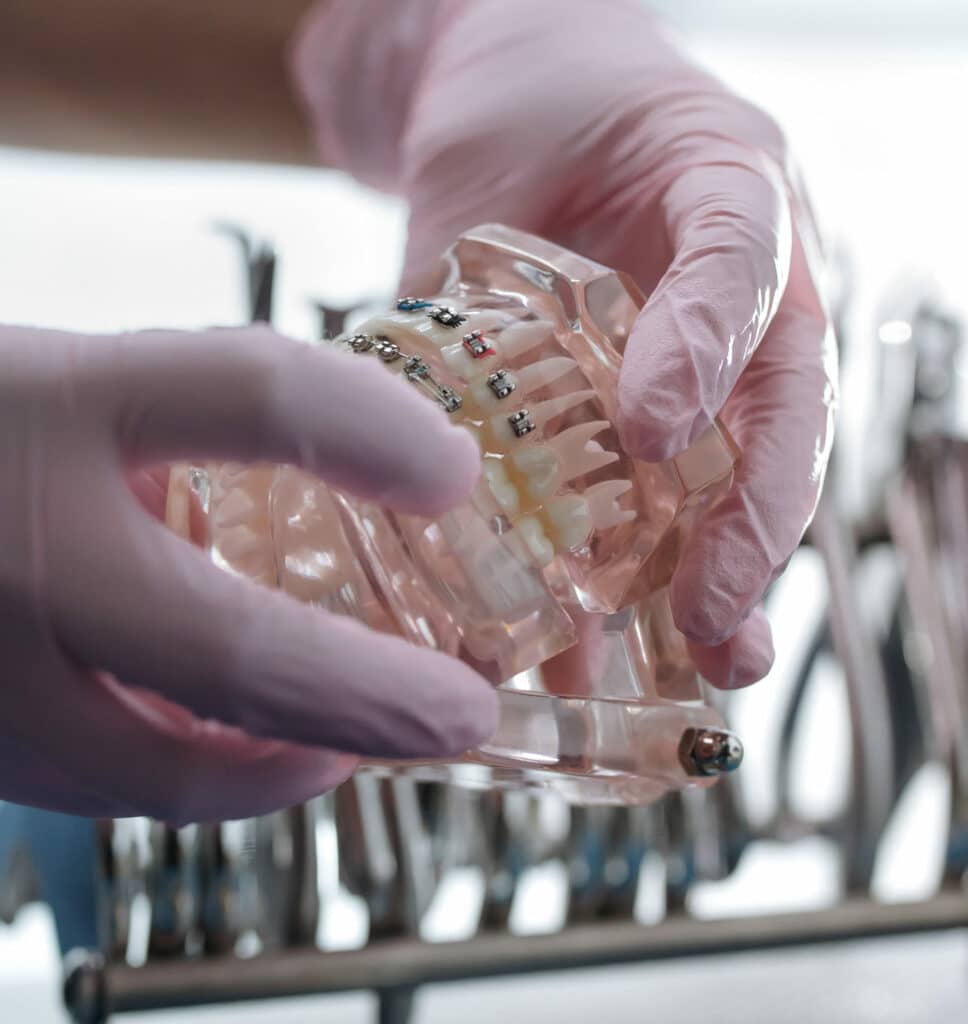 A Brief Guide to Invisalign and Braces Sprayberry Orthodontics in Auburn, AL