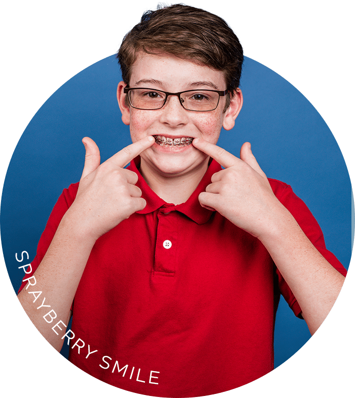 Common Bite Problems Sprayberry Orthodontics in Auburn, AL